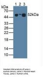 Leucine Rich Alpha-2-Glycoprotein 1 (LRG1) Antibody