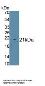 Haptoglobin Beta Chain (HP) Antibody