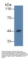 Haptoglobin Beta Chain (HP) Antibody