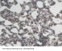Interleukin 6 (IL6) Antibody