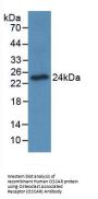 Osteoclast Associated Receptor (OSCAR) Antibody