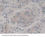 Nestin (NES) Antibody