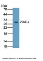 Integrin Beta 6 (ITGb6) Antibody