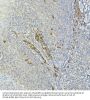Tyrosine-Protein Kinase Tec (TEC) Antibody