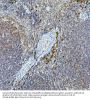 Tyrosine-Protein Kinase Tec (TEC) Antibody