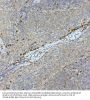Tyrosine-Protein Kinase Tec (TEC) Antibody