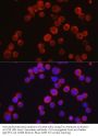 Tyrosine-Protein Kinase Tec (TEC) Antibody