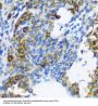 Protein Patched Homolog 1 (PTCH1) Antibody