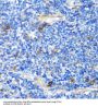 Protein Patched Homolog 1 (PTCH1) Antibody