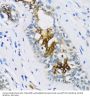 Protein Patched Homolog 1 (PTCH1) Antibody