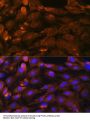 Protein Patched Homolog 1 (PTCH1) Antibody