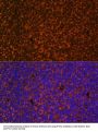 Protein Patched Homolog 1 (PTCH1) Antibody
