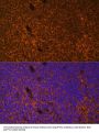 Protein Patched Homolog 1 (PTCH1) Antibody