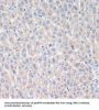 Leucine-Rich Repeat Serine/Threonine-Protein Kinase 2 (LRRK2) Antibody