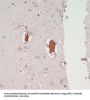Leucine-Rich Repeat Serine/Threonine-Protein Kinase 2 (LRRK2) Antibody