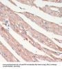 Leucine-Rich Repeat Serine/Threonine-Protein Kinase 2 (LRRK2) Antibody