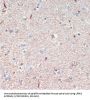 Leucine-Rich Repeat Serine/Threonine-Protein Kinase 2 (LRRK2) Antibody