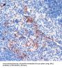 Leucine-Rich Repeat Serine/Threonine-Protein Kinase 2 (LRRK2) Antibody