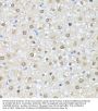 Casein Kinase II Subunit Alpha (CSNK2A1) Antibody