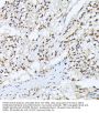 Casein Kinase II Subunit Alpha (CSNK2A1) Antibody