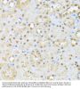 Casein Kinase II Subunit Alpha (CSNK2A1) Antibody