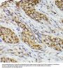 Prostaglandin G/H Synthase 2 / COX-2 (PTGS2) Antibody