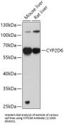 Cytochrome P450 2D6 (CYP2D6) Antibody