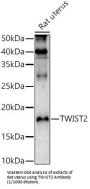 Twist Family BHLH Transcription Factor 2 (TWIST2) Antibody