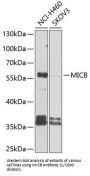 MHC Class I Polypeptide Related Sequence B (MICB) Antibody