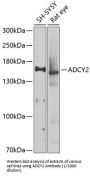 Adenylate Cyclase 2, Brain (ADCY2) Antibody