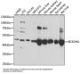 2-Oxoisovalerate Dehydrogenase Subunit Alpha, Mitochondrial (BCKDHA) Antibody