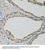 Lipocalin 1 (LCN1) Antibody