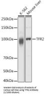 Transferrin Receptor Protein 2 (TFR2) Antibody