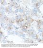 Transferrin Receptor Protein 2 (TFR2) Antibody