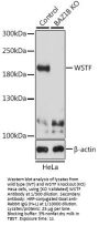 Bromodomain Adjacent To Zinc Finger Domain 1B (BAZ1B) Antibody