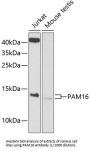 Mitochondrial Import Inner Membrane Translocase Subunit TIM16 (PAM16) Antibody