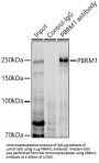 Protein Polybromo-1 (PBRM1) Antibody
