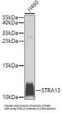 Stimulated By Retinoic Acid Gene 13 Protein Homolog (STRA13) Antibody