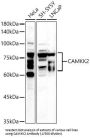Calcium/calmodulin-Dependent Protein Kinase Kinase 2 (CAMKK2) Antibody