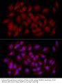 Calcium/calmodulin-Dependent Protein Kinase Kinase 2 (CAMKK2) Antibody