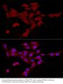 Calcium/calmodulin-Dependent Protein Kinase Kinase 2 (CAMKK2) Antibody