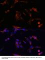 Aquaporin 5 (AQP5) Antibody