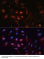 Aquaporin 5 (AQP5) Antibody