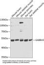 Gamma-Aminobutyric Acid Receptor Subunit Alpha-5 (gABRA5) Antibody