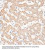 Killer Cell Immunoglobulin-Like Receptor 3DS1 (KIR3DS1) Antibody
