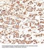 Killer Cell Immunoglobulin-Like Receptor 3DS1 (KIR3DS1) Antibody