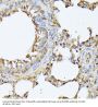 Proteasome Subunit Beta Type 3 (PSMB3) Antibody