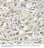 Proteasome Subunit Beta Type 3 (PSMB3) Antibody