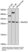 Eosinophil Derived Neurotoxin (RNASE2) Antibody
