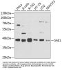 SUMO-Activating Enzyme Subunit 1 (SAE1) Antibody